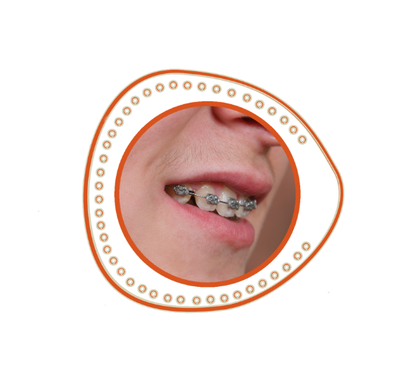 feller-braces-care-01